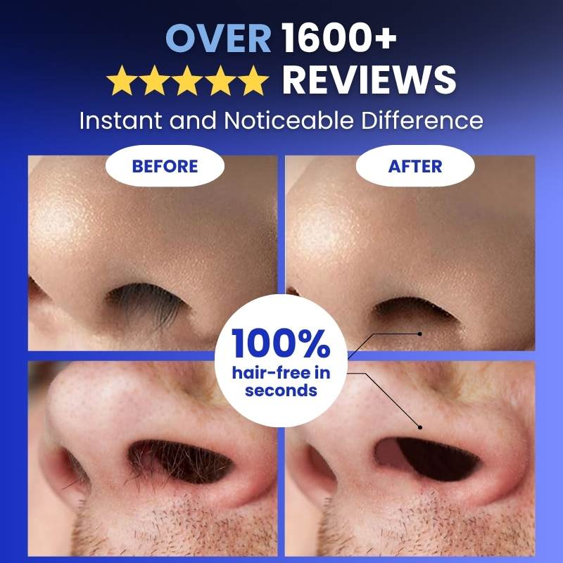 Esvitae Nose & Ear Hair Trimmer